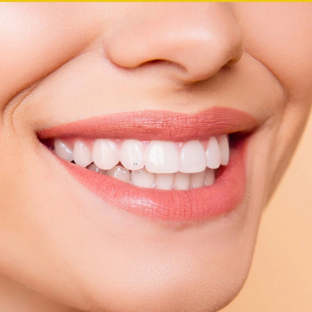 Crystal Clear 1.8mm 5-pack - Image 3